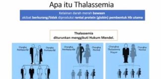 Penyakit Thalassemia tidak Dapat Disembuhkan tapi Dapat Dihindari Direktur Jenderal (Dirjen) Pencegahan dan Pengendalian Penyakit, Kementerian Kesehatan (Kemenkes) dr. Maxi Rein Rondonuwu mengatakan sampai saat ini thalassemia belum bisa disembuhkan namun dapat dicegah dan diidentifikasi pembawa sifat thalassemia F,kemkes